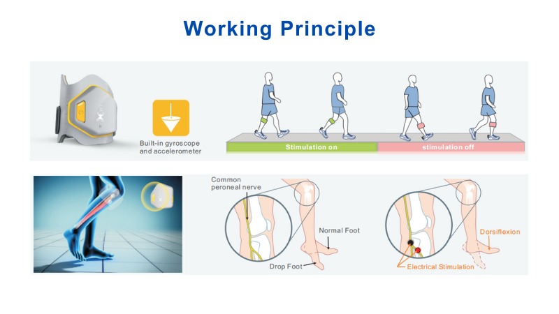 XFT-2001D G3 Foot Drop System - Working Principle